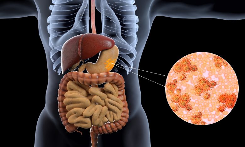 Cest-plus-quune-simple-rulure-destomac-reconnaitre-les-symptomes-du-cancer-de-lestomac