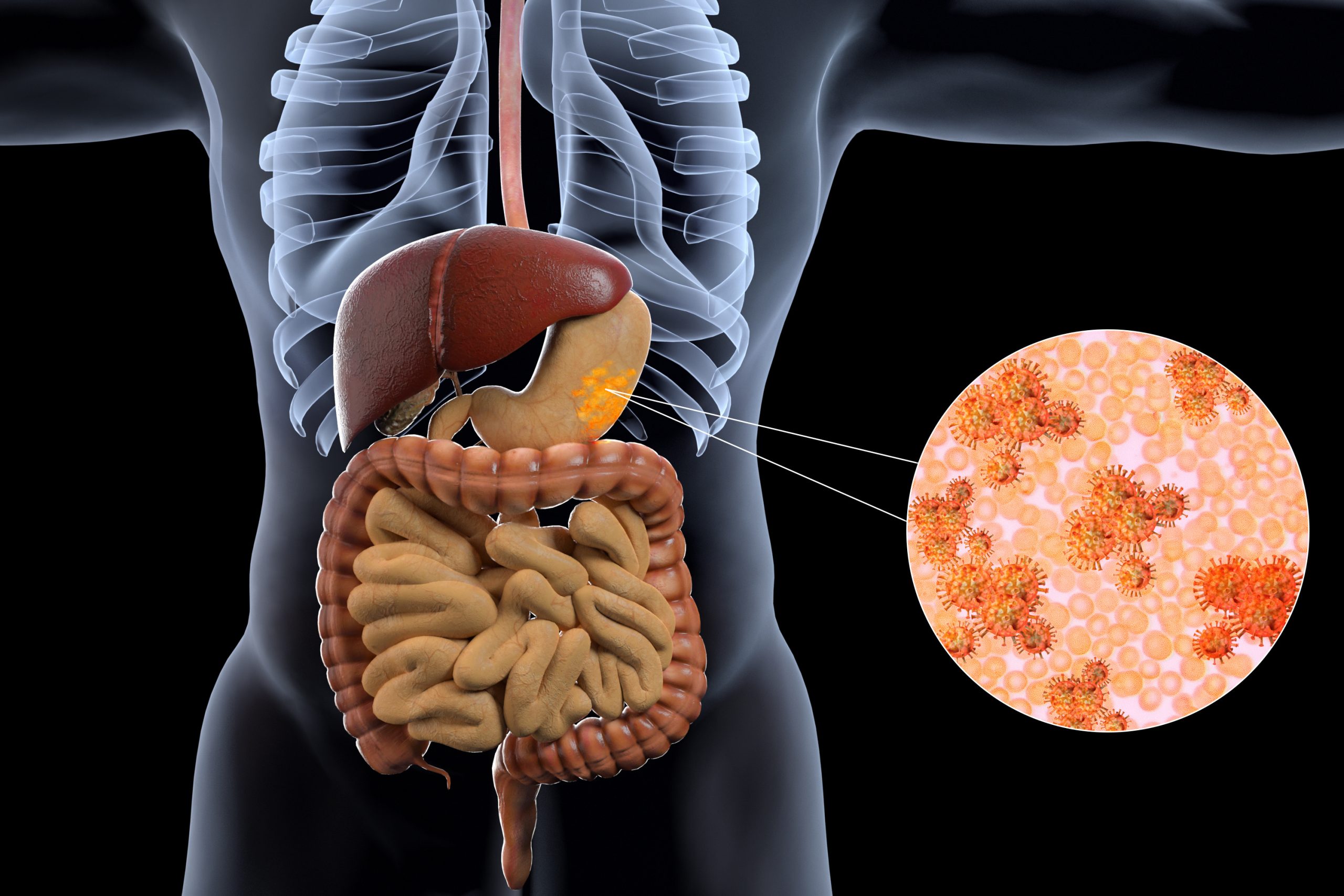 Cest-plus-quune-simple-rulure-destomac-reconnaitre-les-symptomes-du-cancer-de-lestomac