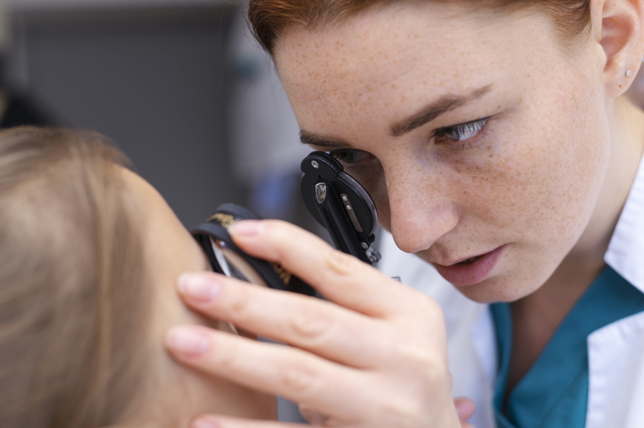 Blépharite comprendre et prendre soin de ses paupières.