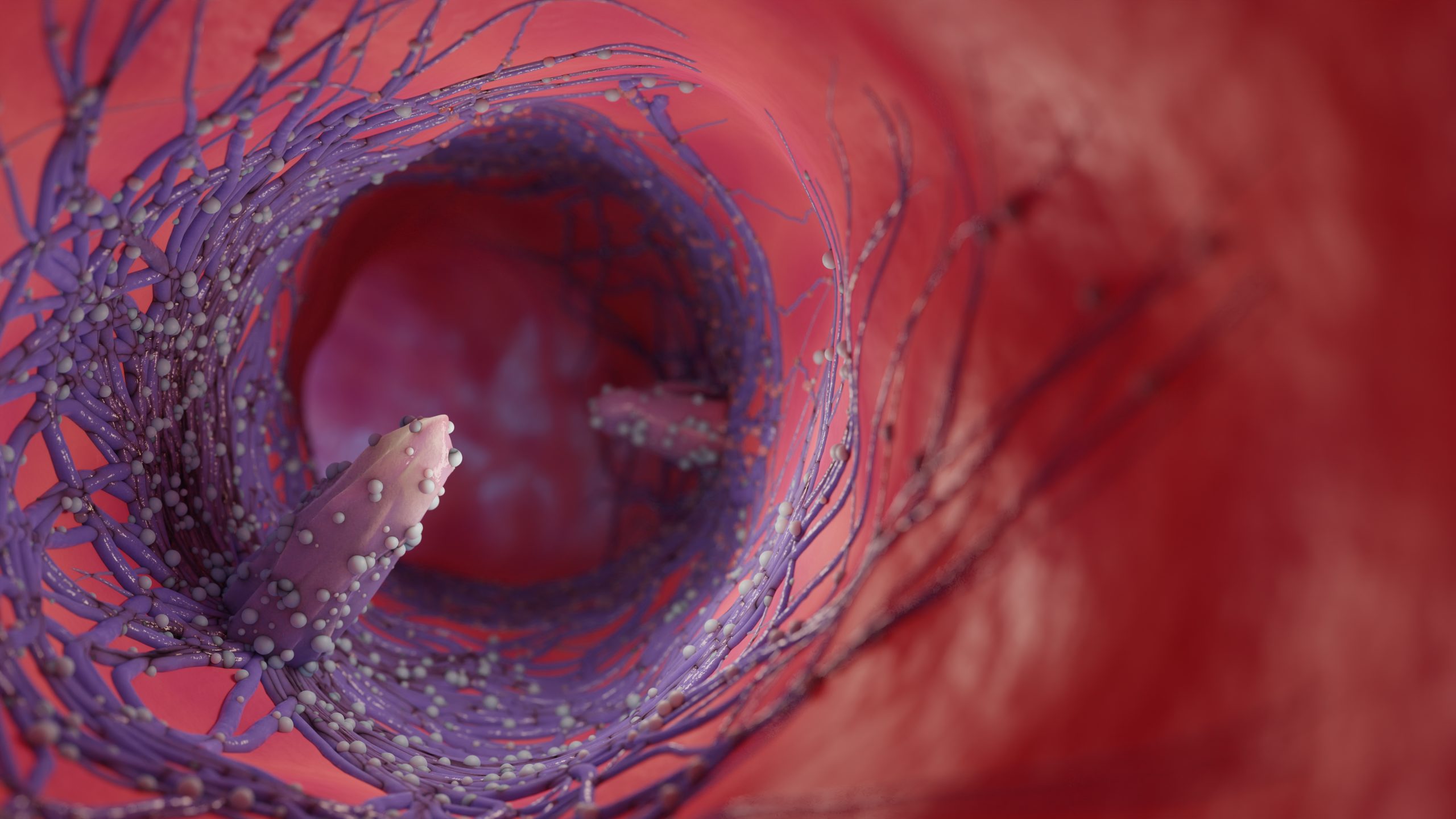 Exploration approfondie des symptômes, diagnostics et options de traitement de l'Œsophagite Éosinophilique.