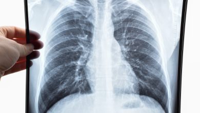 Plongez dans l'univers des pneumoconioses, comprenez l'impact de l'anthracose et de l'asbestose sur la santé pulmonaire.