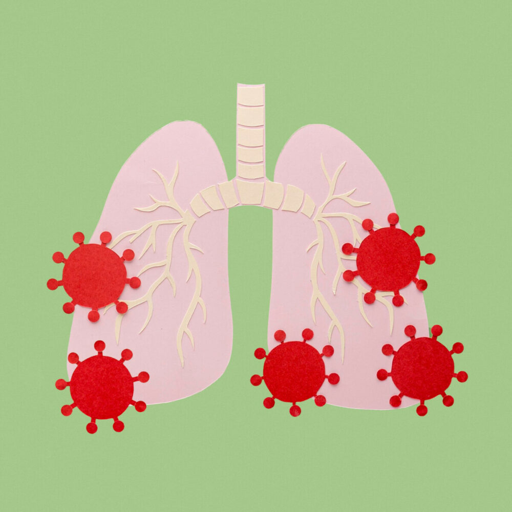 Découvrez les Impacts de la mucoviscidose sur la santé respiratoire tout ce que vous devez savoir