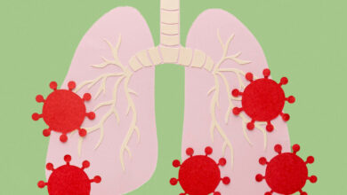 Découvrez les Impacts de la mucoviscidose sur la santé respiratoire tout ce que vous devez savoir