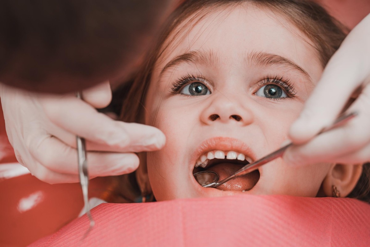 Découvrez à quel Âge poussent les dents de sagesse et leurs signes avant-coureurs