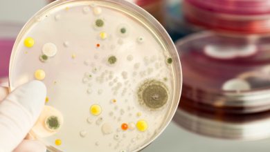 La listeria symptômes, aliments risqués, prévention et populations vulnérables