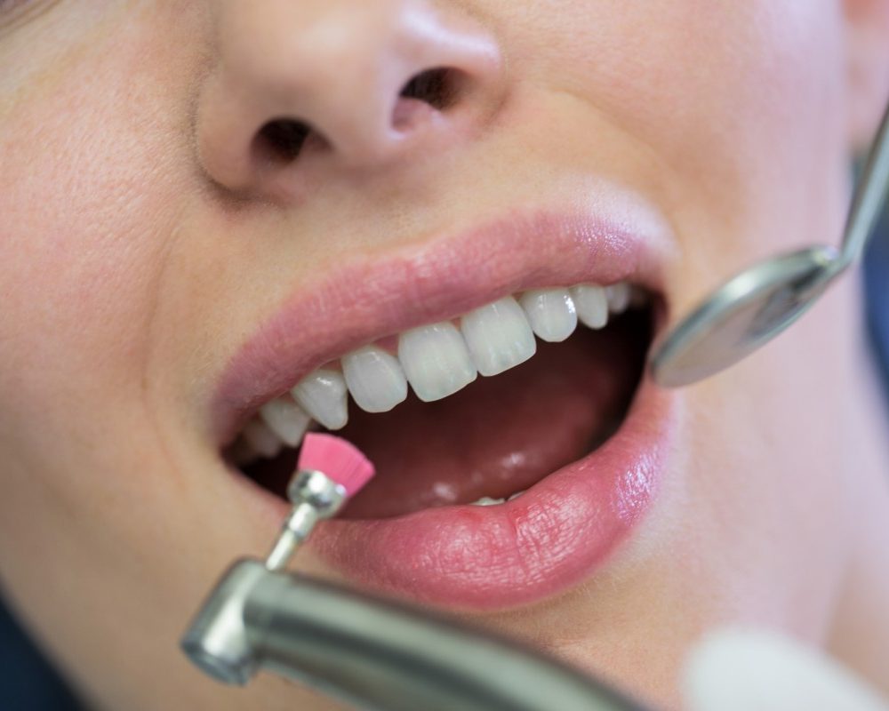 La dentisterie du futur bientôt un médicament pour faire repousser les dents naturelles