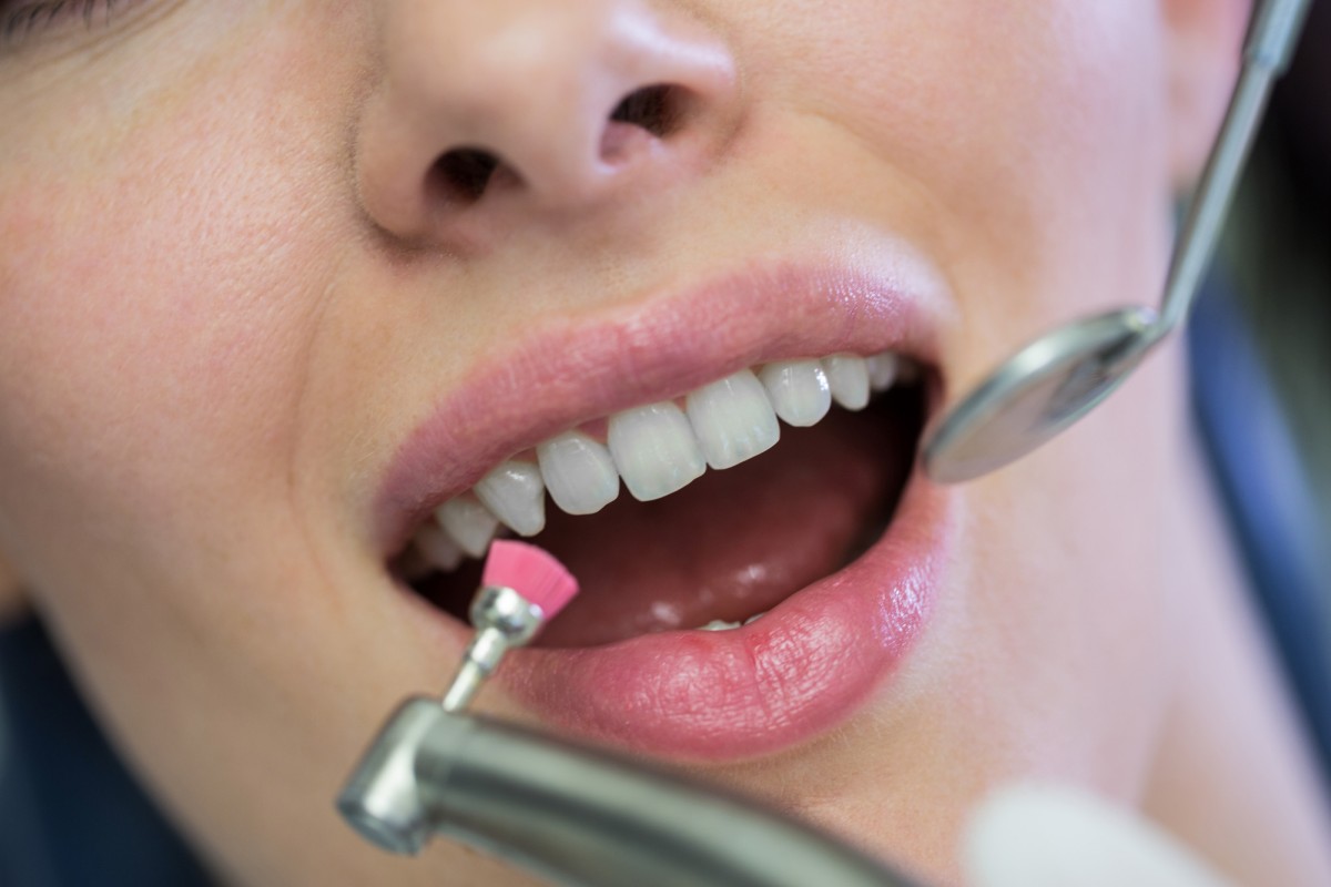 La dentisterie du futur bientôt un médicament pour faire repousser les dents naturelles