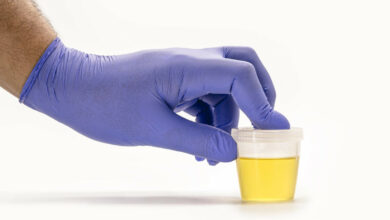 Découvrez comment le goût de l'urine peut révéler des problèmes de santé sous-jacents