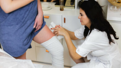 Saviez-vous que le lipoedème est la cause des jambes poteaux ? Découvrez tout ici !