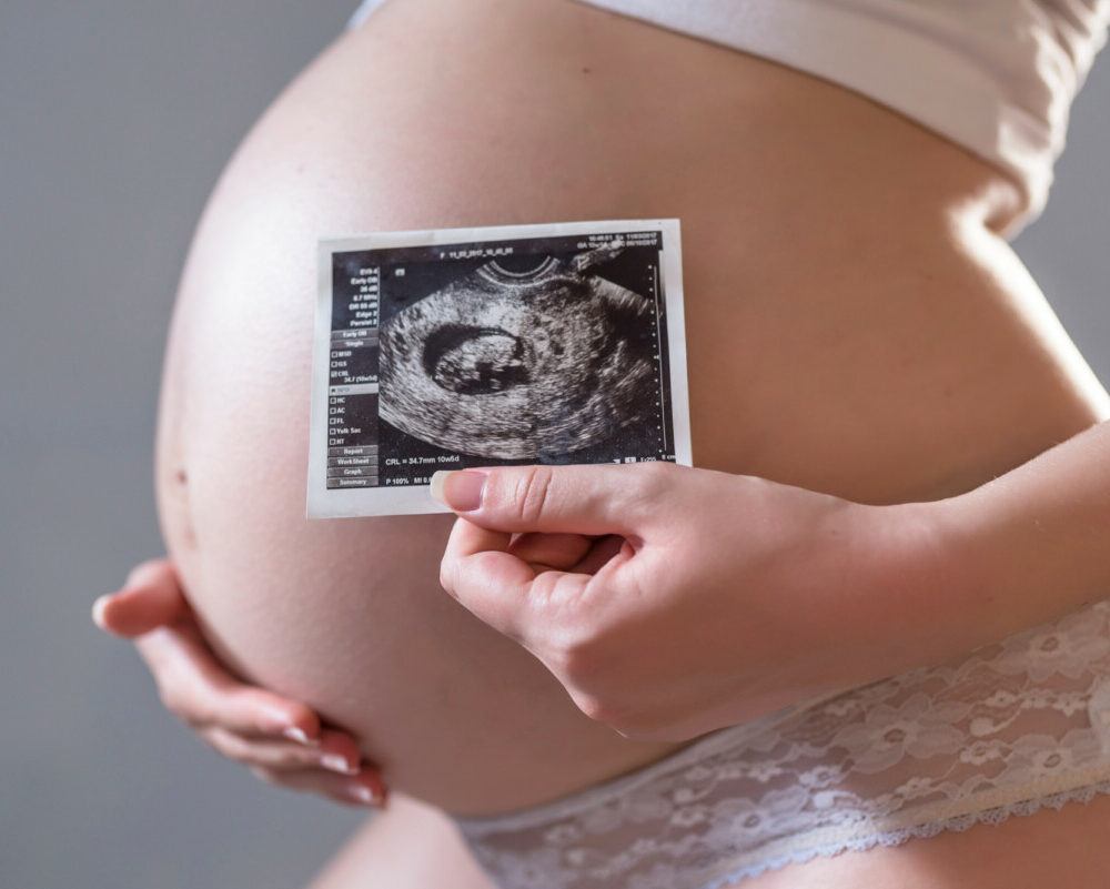 Découvrez l'incroyable histoire de la femme portant un lithopédion pendant neuf longues années