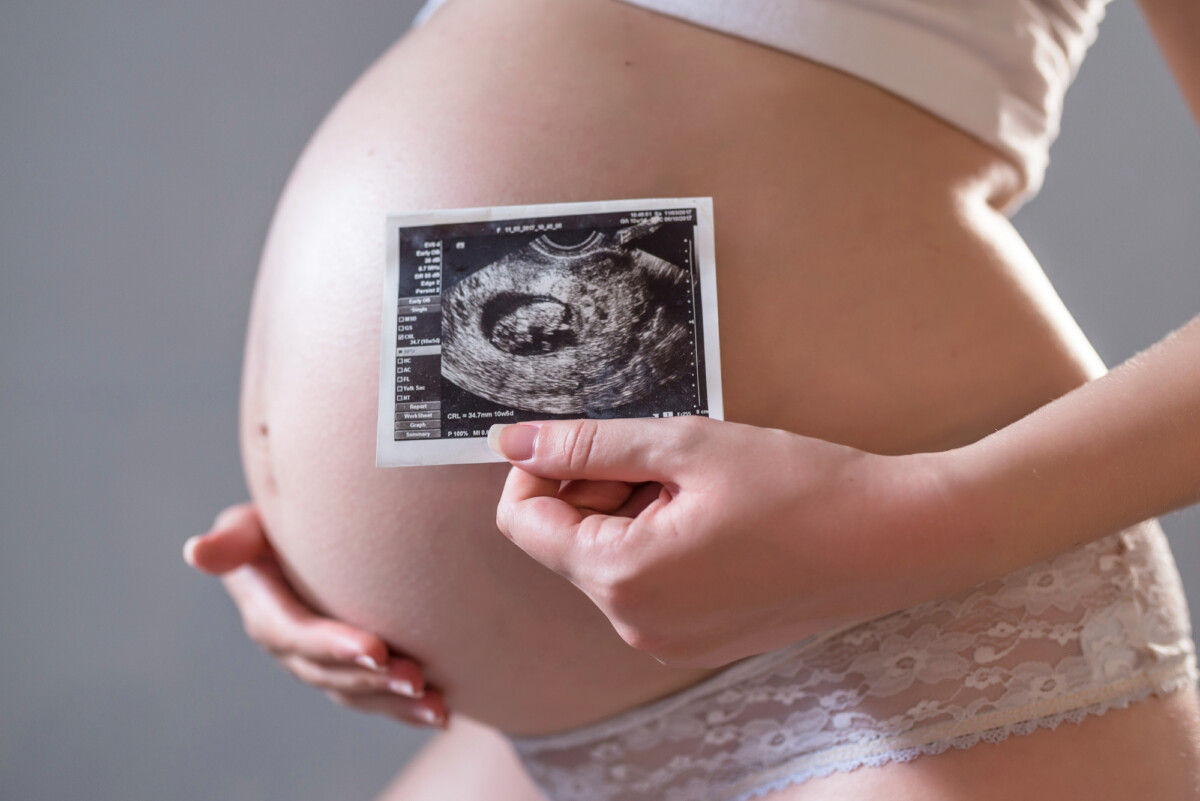 Découvrez l'incroyable histoire de la femme portant un lithopédion pendant neuf longues années