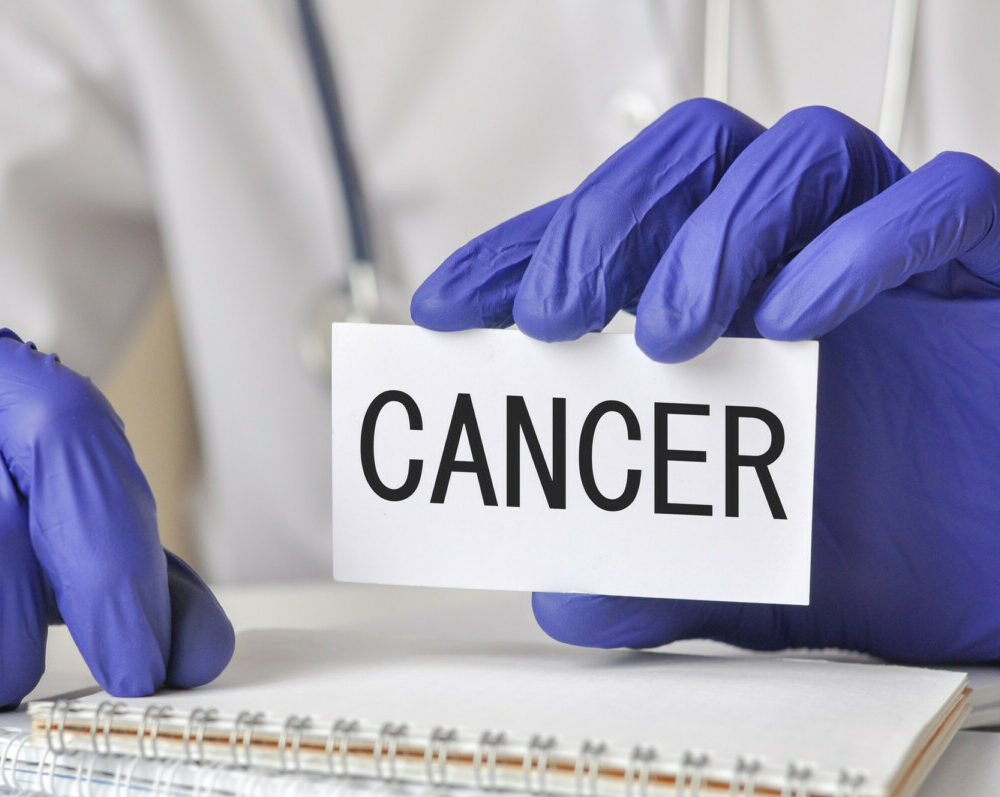 Détection précoce du cancer colorectal les signes à ne pas ignorer