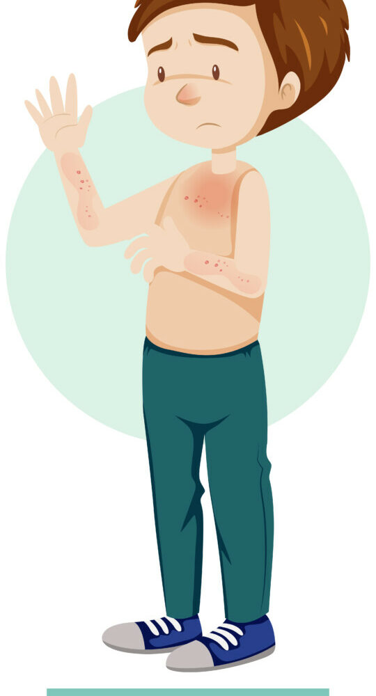 cartoon-character-with-skin-rashes-symptoms