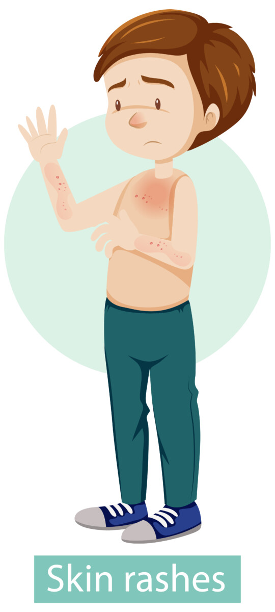 cartoon-character-with-skin-rashes-symptoms