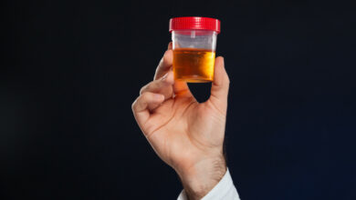 close-up-male-s-hand-holding-container-with-urine-sample